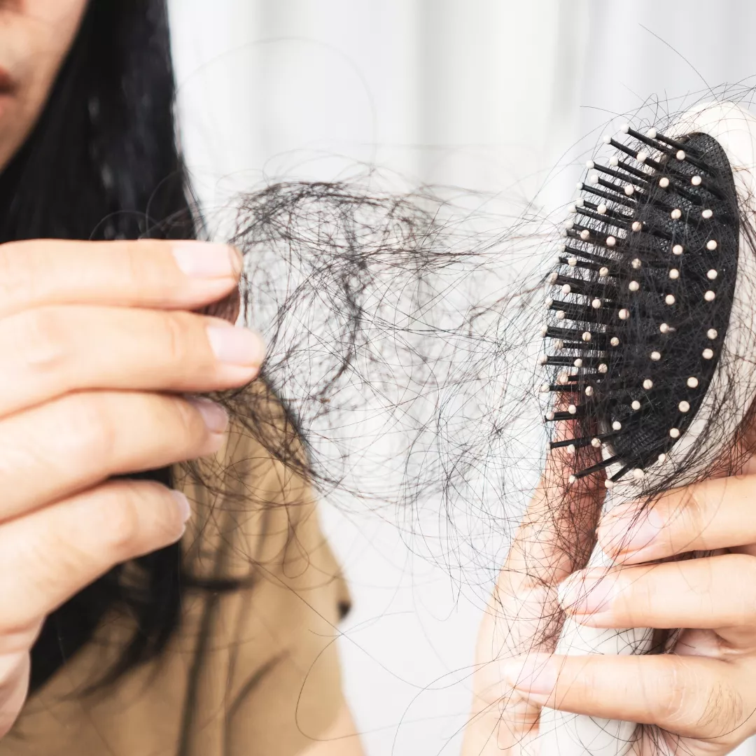 נשירת-שיער.b197b0